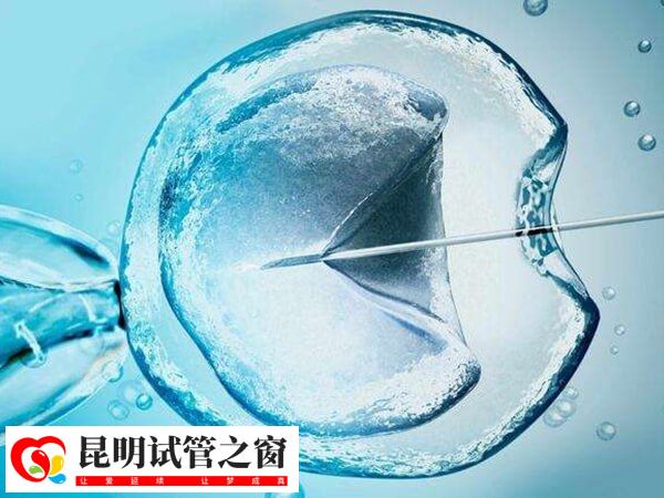 昆明云大医院可以做供卵试管婴儿助孕吗？(图1)